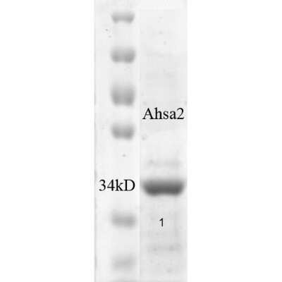 SDS-PAGE: Recombinant Human AHSA2 His Protein [NBP3-18325]