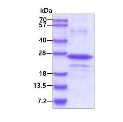 SDS-PAGE: Recombinant Human ARC/NOL3 His Protein [NBP2-23300]