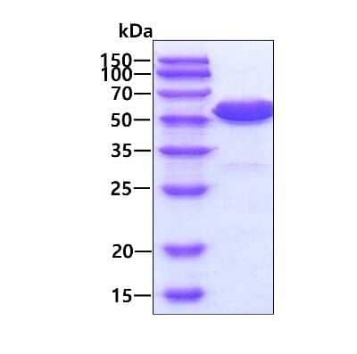 SDS-PAGE: Recombinant Human Annexin A11 His Protein [NBP1-50857]