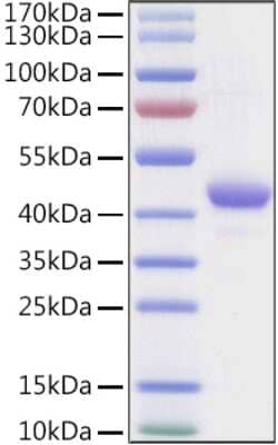 SDS-PAGE: Recombinant Human Apolipoprotein A-II/ApoA2 Fc Avi-tag Protein [NBP3-18197]