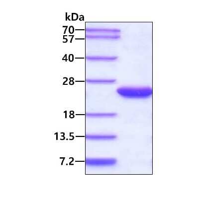 SDS-PAGE: Recombinant Human BAFF/BLyS/TNFSF13B His Protein [NBC1-18481]