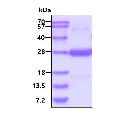 SDS-PAGE: Recombinant Human BNIP1 His Protein [NBP2-51920]