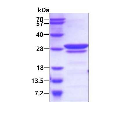 SDS-PAGE: Recombinant Human CAMLG His Protein [NBP2-22725]