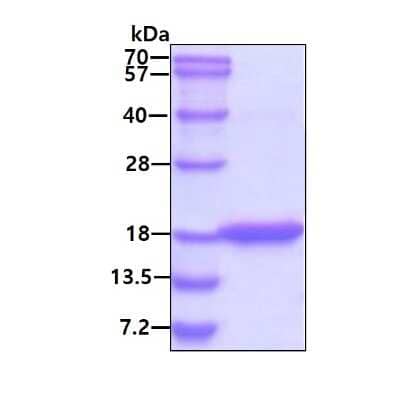 SDS-PAGE: Recombinant Human CEBP gamma His Protein [NBC1-18420]