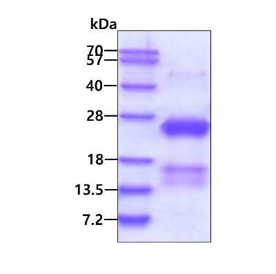 SDS-PAGE: Recombinant Human CSRP2 His Protein [NBP1-98997]