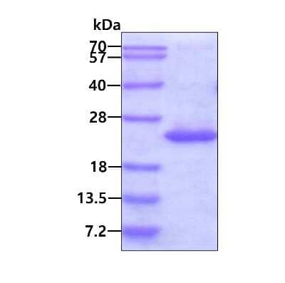 SDS-PAGE: Recombinant Human Centrin 1 His Protein [NBP1-98983]