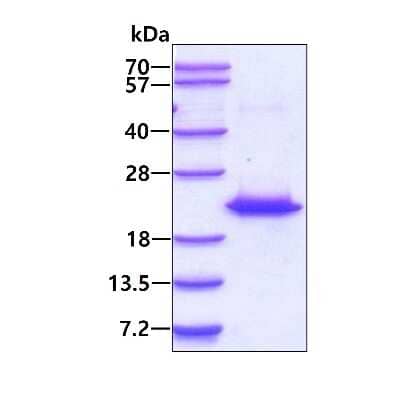 SDS-PAGE: Recombinant Human Centrin 2 His Protein [NBP1-50938]