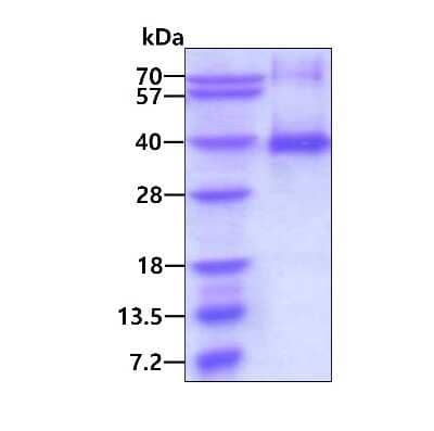 SDS-PAGE: Recombinant Human Cyclin G His Protein [NBP1-78830]