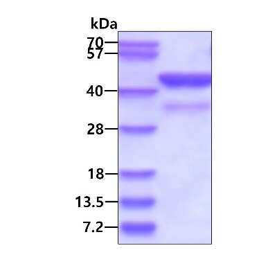 SDS-PAGE: Recombinant Human Cyclophilin 40 His Protein [NBC1-18427]