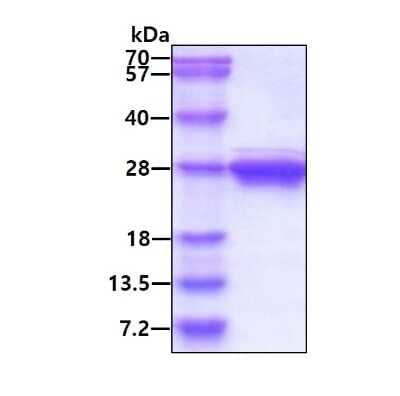 SDS-PAGE: Recombinant Human Cytoglobin His Protein [NBP1-45257]