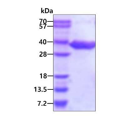 SDS-PAGE: Recombinant Human DECR1 His Protein [NBP1-51054]