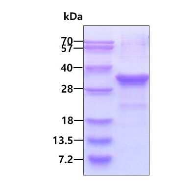 SDS-PAGE: Recombinant Human DENR His Protein [NBP1-72446]