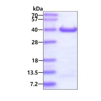 SDS-PAGE: Recombinant Human DIMT1L His Protein [NBP1-98909]