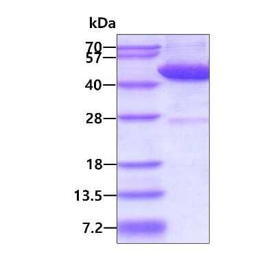 SDS-PAGE: Recombinant Human Dnmt2 His Protein [NBP1-99030]