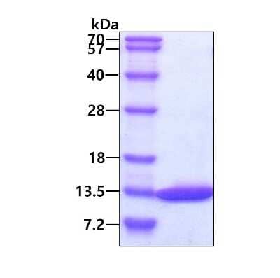 SDS-PAGE: Recombinant Human Dynein light chain 2a cytoplasmic His Protein [NBP1-45306]