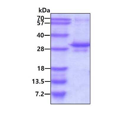 SDS-PAGE: Recombinant Human EGLN3/PHD3 His Protein [NBP2-53035]