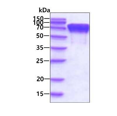 SDS-PAGE: Recombinant Human ERp72 His Protein [NBP2-52141]