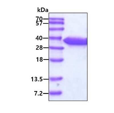 SDS-PAGE: Recombinant Human Fumarase Protein [NBC1-18871]