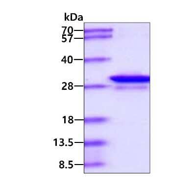 SDS-PAGE: Recombinant Human GAS41 His Protein [NBP1-78864]