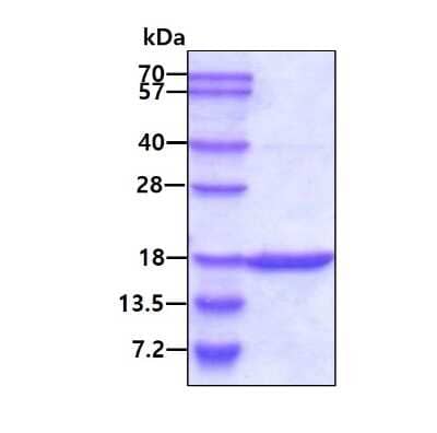 SDS-PAGE: Recombinant Human GMFG Protein [NBC1-19063]