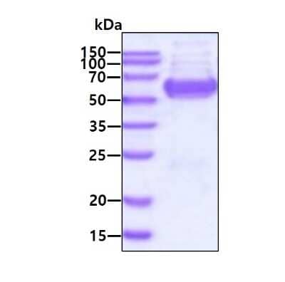 SDS-PAGE: Recombinant Human GPT2 His Protein [NBP2-23077]