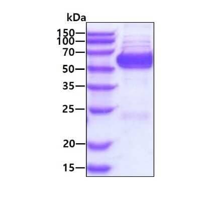 SDS-PAGE: Recombinant Human GPT2 His Protein [NBP3-18182]