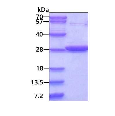 SDS-PAGE: Recombinant Human GSTT2 His Protein [NBP1-99060]