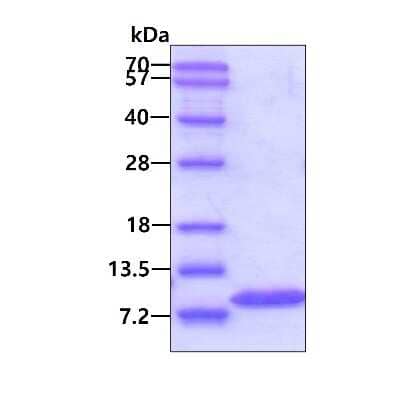 SDS-PAGE: Recombinant Human Glutaredoxin 1/GLRX1 Protein [NBC1-22929]