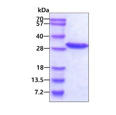 SDS-PAGE: Recombinant Human Grancalcin His Protein [NBP1-50967]