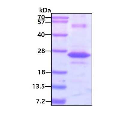 SDS-PAGE: Recombinant Human Gremlin 1 His Protein [NBP2-23088]