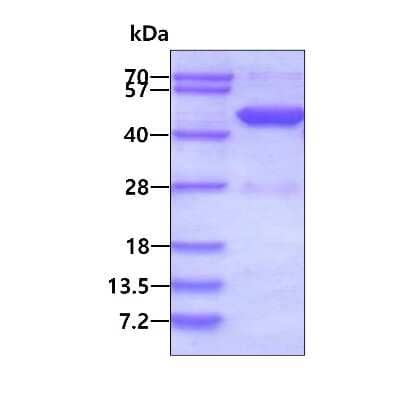 SDS-PAGE: Recombinant Human HPD His Protein [NBP1-49443]