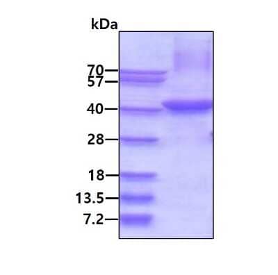 SDS-PAGE: Recombinant Human HPR His Protein [NBP2-51595]