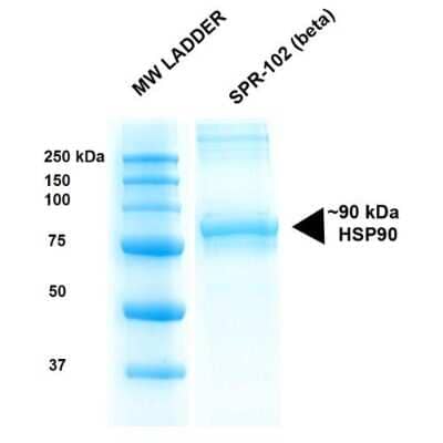 SDS-PAGE: Recombinant Human HSP90 beta Protein [NBP3-18320]