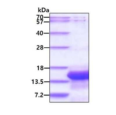 SDS-PAGE: Recombinant Human IER3 His Protein [NBP2-23130]