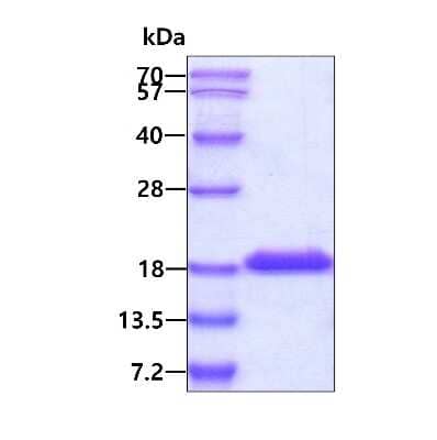 SDS-PAGE: Recombinant Human IL-38/IL-1F10 Protein [NBP2-52047]