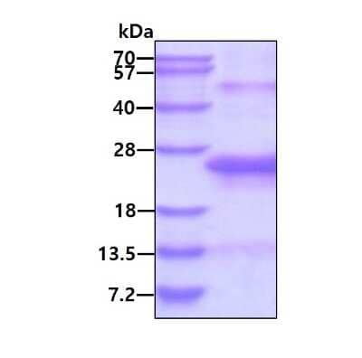 SDS-PAGE: Recombinant Human IgJ His Protein [NBP2-23132]