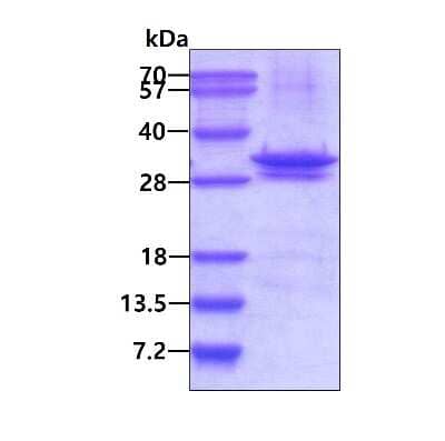 SDS-PAGE: Recombinant Human LIN7 His Protein [NBP2-23197]