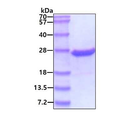 SDS-PAGE: Recombinant Human LMP2/PSMB9 His Protein [NBP1-51067]