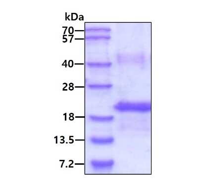 SDS-PAGE: Recombinant Human M-CSF His Protein [NBP1-30174]