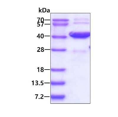 SDS-PAGE: Recombinant Human MAD2L1-binding protein His Protein [NBP1-99078]