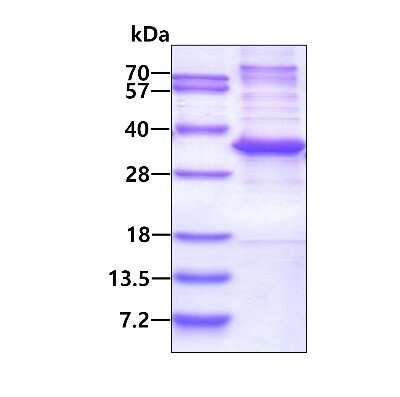 SDS-PAGE: Recombinant Human MED7 His Protein [NBP2-23222]