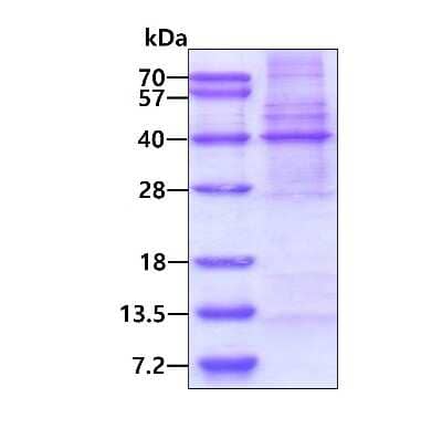 SDS-PAGE: Recombinant Human MLF1 Interacting Protein His Protein [NBP2-23247]