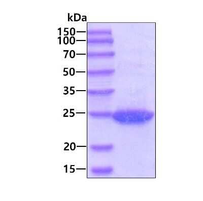 SDS-PAGE: Recombinant Human MYL4 His Protein [NBP1-72550]