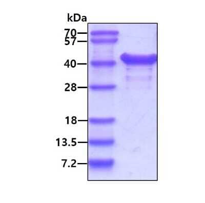 SDS-PAGE: Recombinant Human NACA1 His Protein [NBP1-72525]