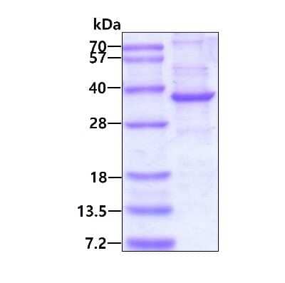 SDS-PAGE: Recombinant Human NEURL2 His Protein [NBP2-23277]