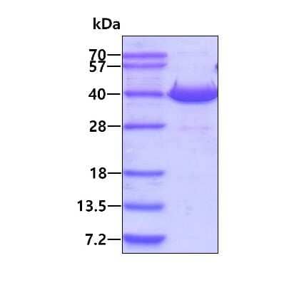 SDS-PAGE: Recombinant Human NFKBID His Protein [NBP2-23296]