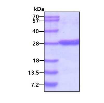 SDS-PAGE: Recombinant Human NT5M His Protein [NBP1-72408]