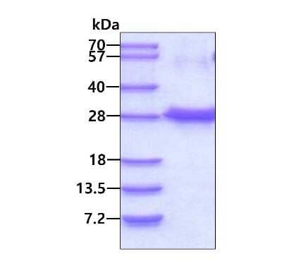 SDS-PAGE: Recombinant Human NUDT4 His Protein [NBP2-23304]