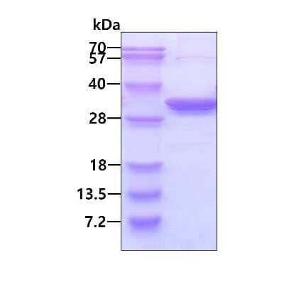 SDS-PAGE: Recombinant Human PA28 Activator beta Subunit/PSME2 His Protein [NBP1-72527]