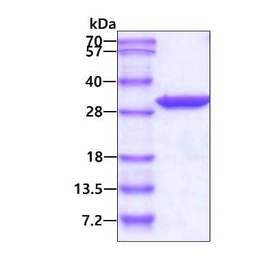 SDS-PAGE: Recombinant Human PCMT1 His Protein [NBP1-44464]